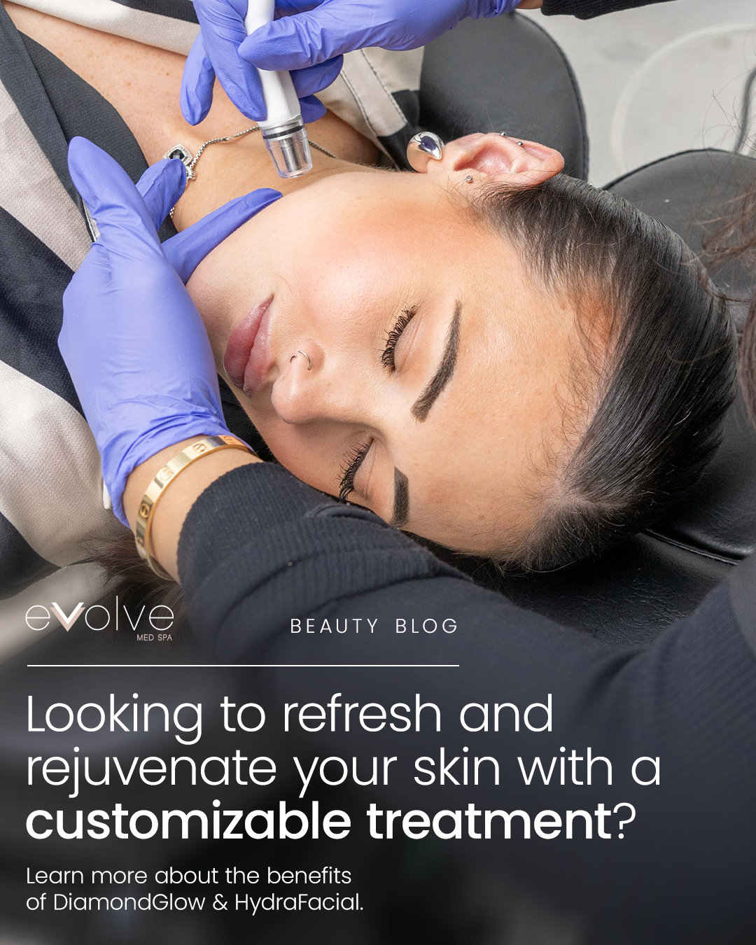 Evolve Med Spa Facebook ad: Refresh Your Skin for Only $125