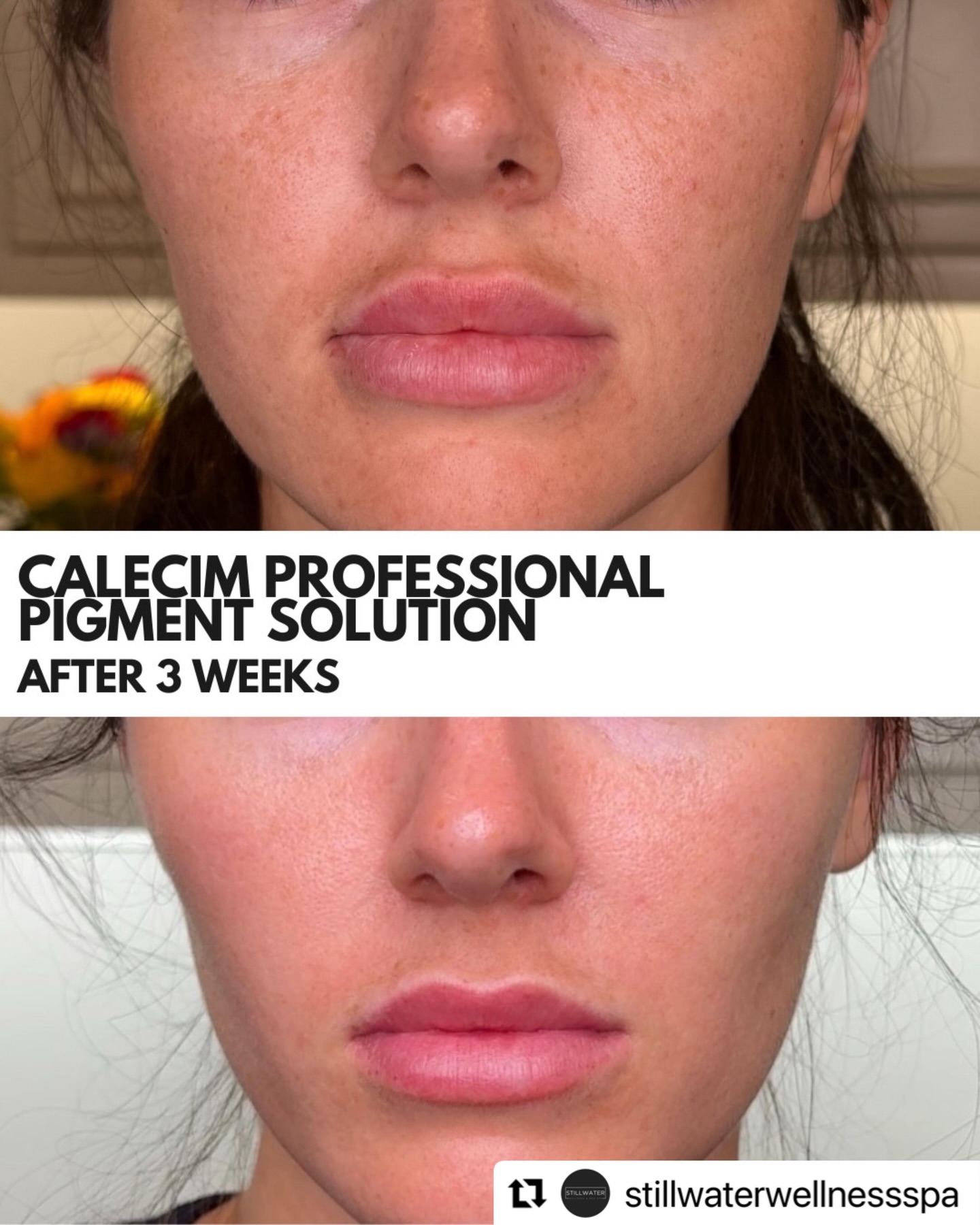Calecim Professional Facebook ad