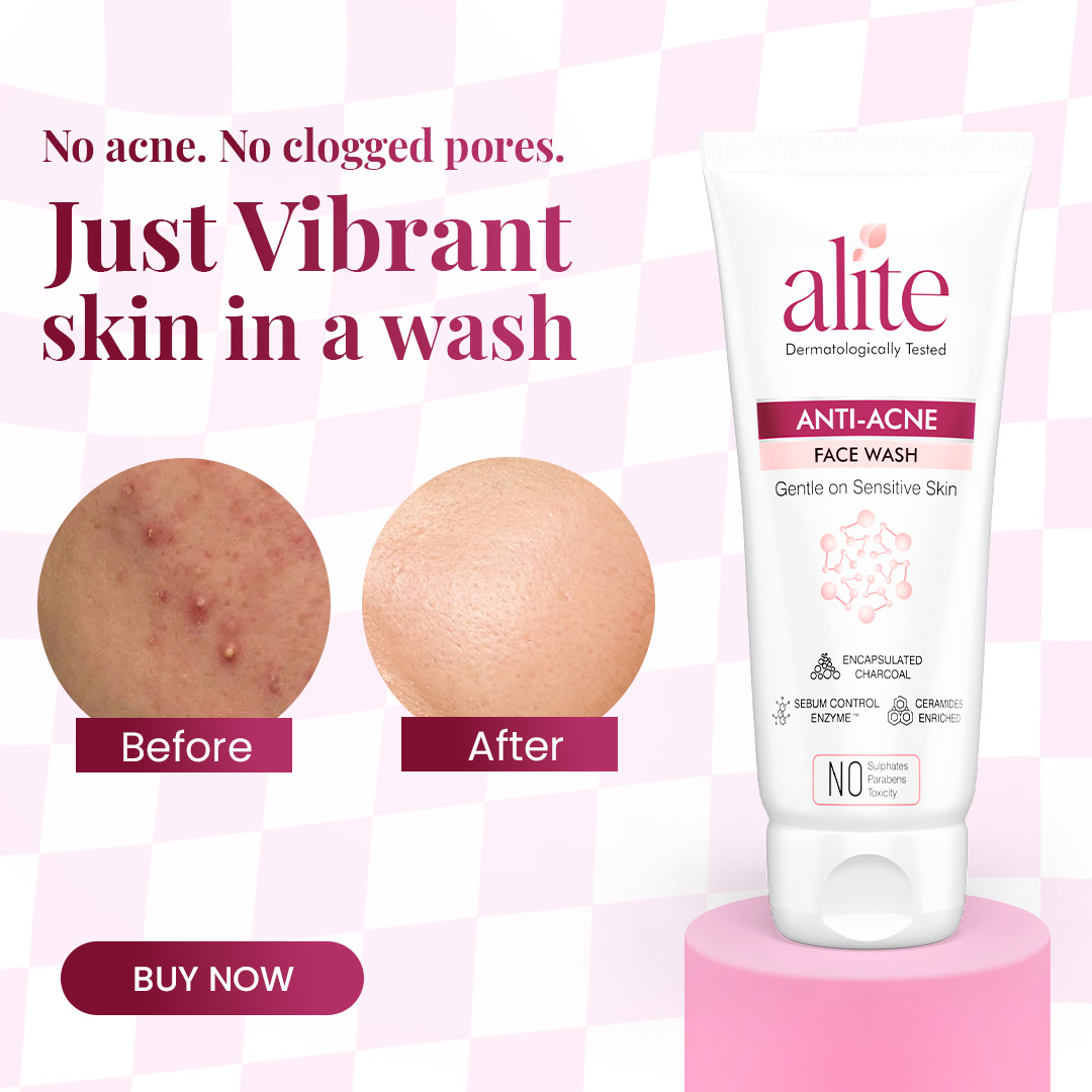 Anushka Sen Facebook ad: Unclog Pores & Control Acne Daily