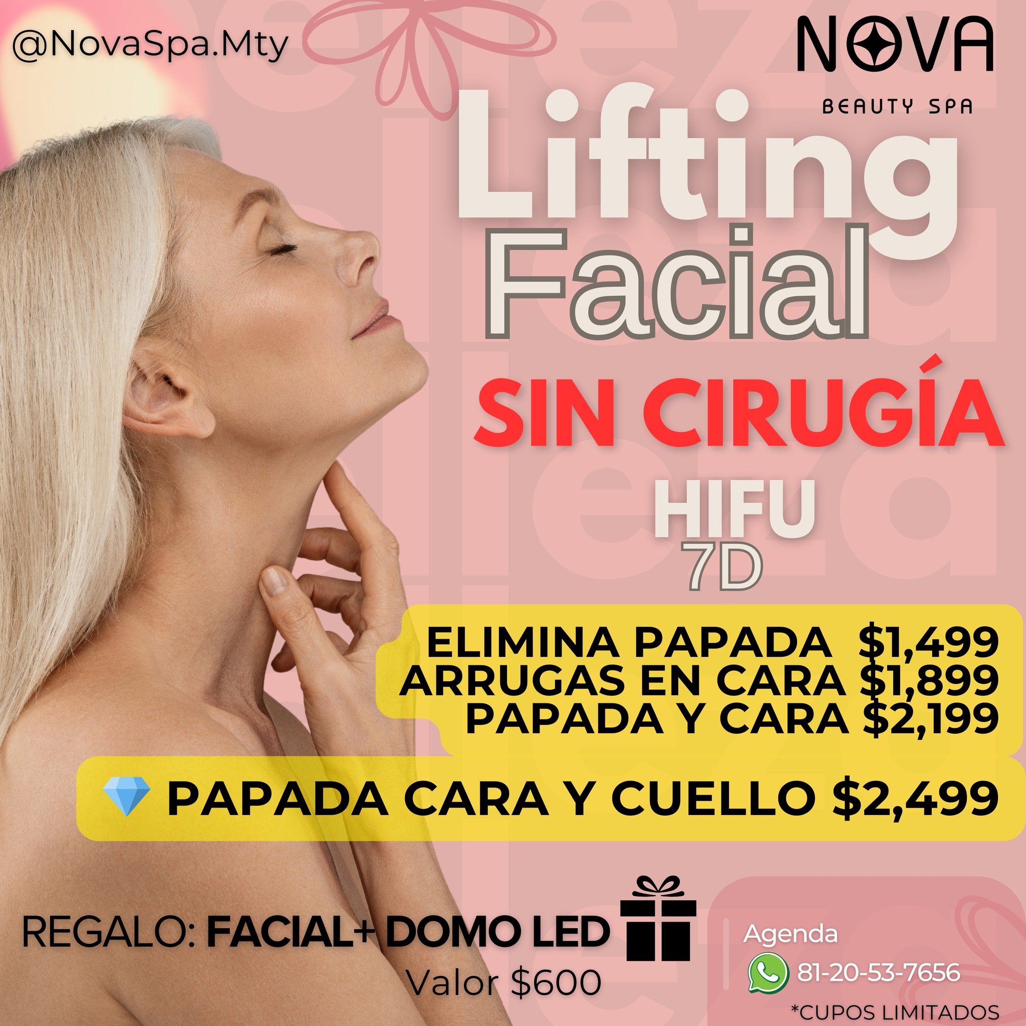 Nova SPA Monterrey Facebook ad: ¡LO ÚLTIMO EN LIFTING SIN CIRUGÍA!
