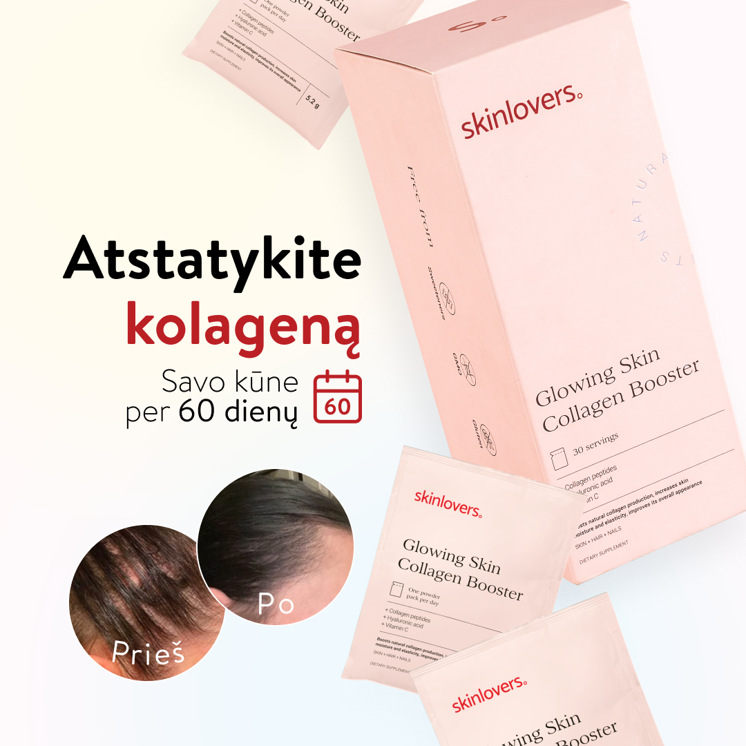 Skinlovers Facebook ad
