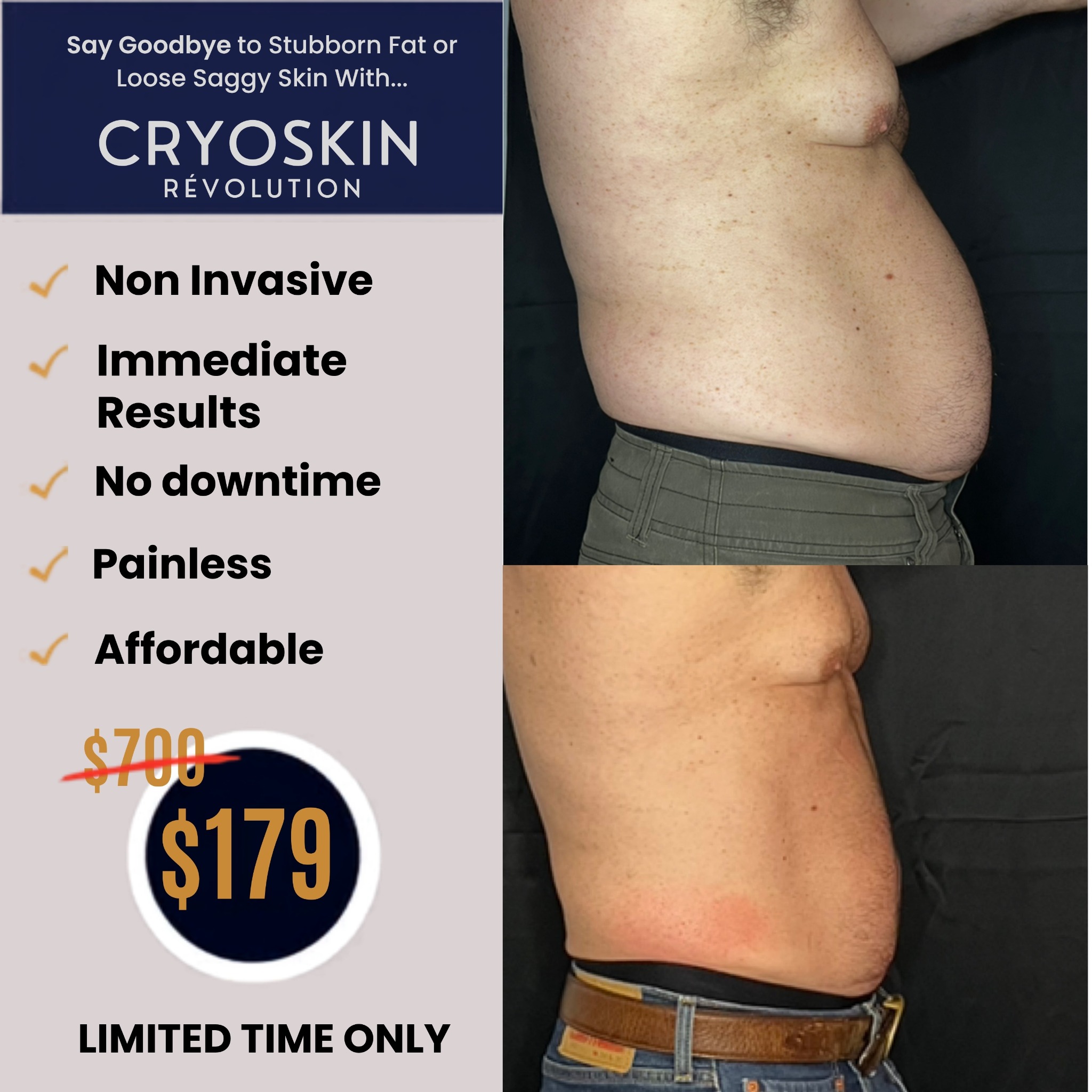 US Cryotherapy - Danville / San Ramon Facebook ad: Time To Fix Your Loose Skin