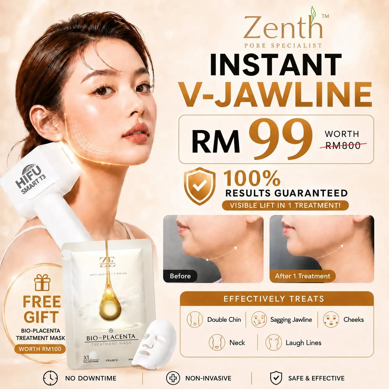 Zenth Pore Specialist Facebook ad: γ ππππ πππ
π π
πππ ππ’ππ γ