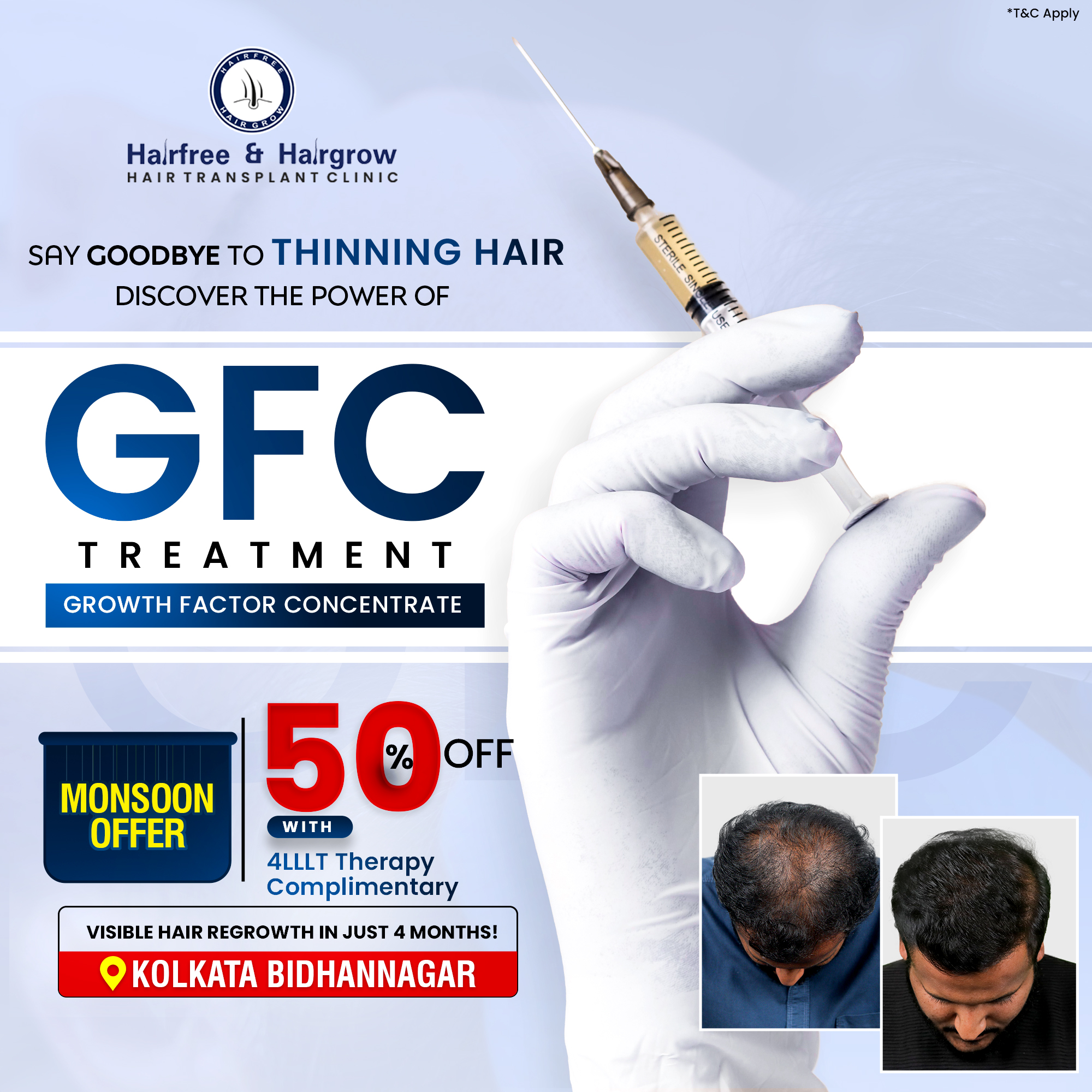 Hairfree Hairgrow Clinic Facebook ad