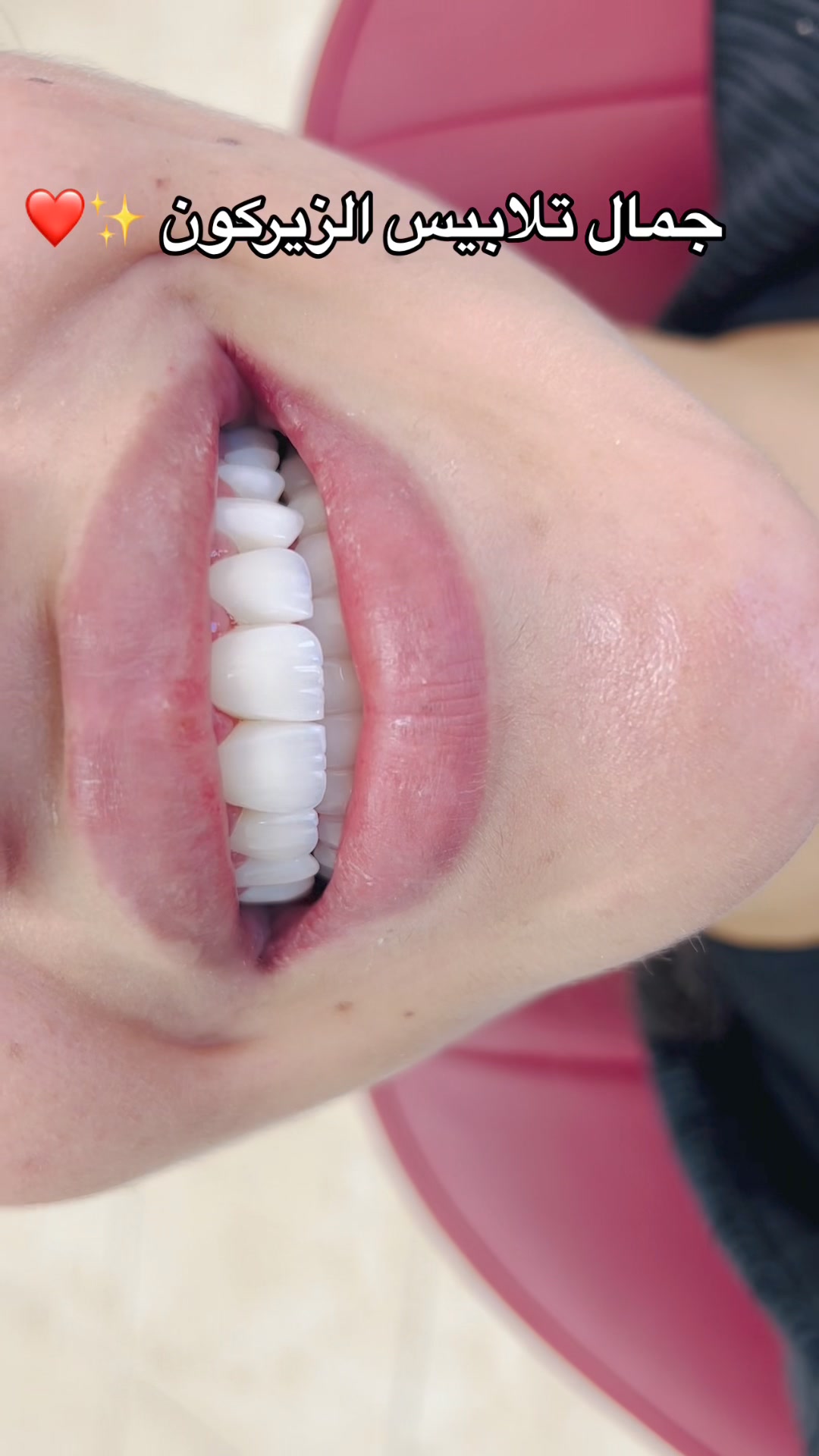 Dr.smile - Dr.Ihab Aqel Facebook ad: #drihab #zirconcrowns #تجميل