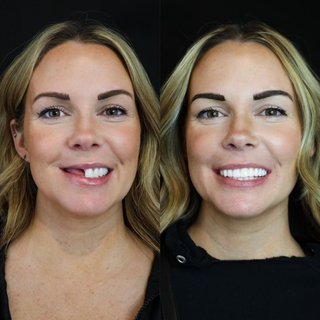 Your Family Dentist Liverpool Facebook ad: PAYMENT PLAN FROM $42/WEEK