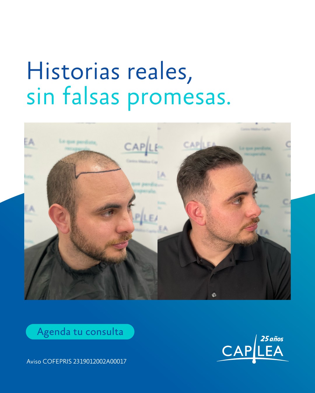 Capilea México Facebook ad