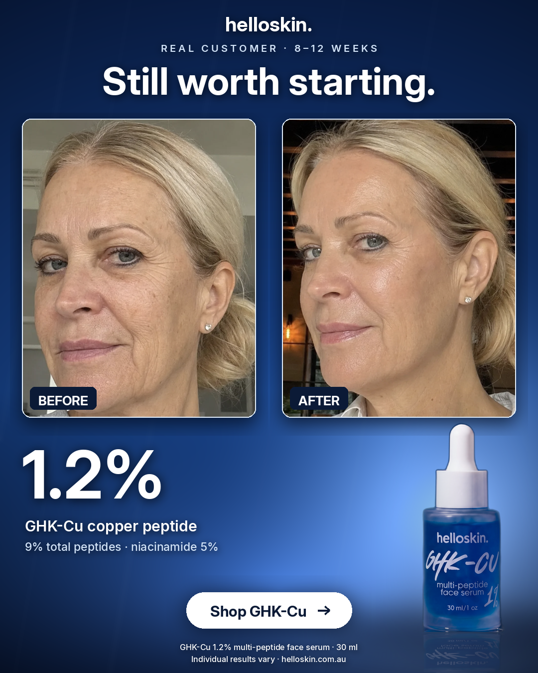 Helloskin Facebook ad: Still worth starting.