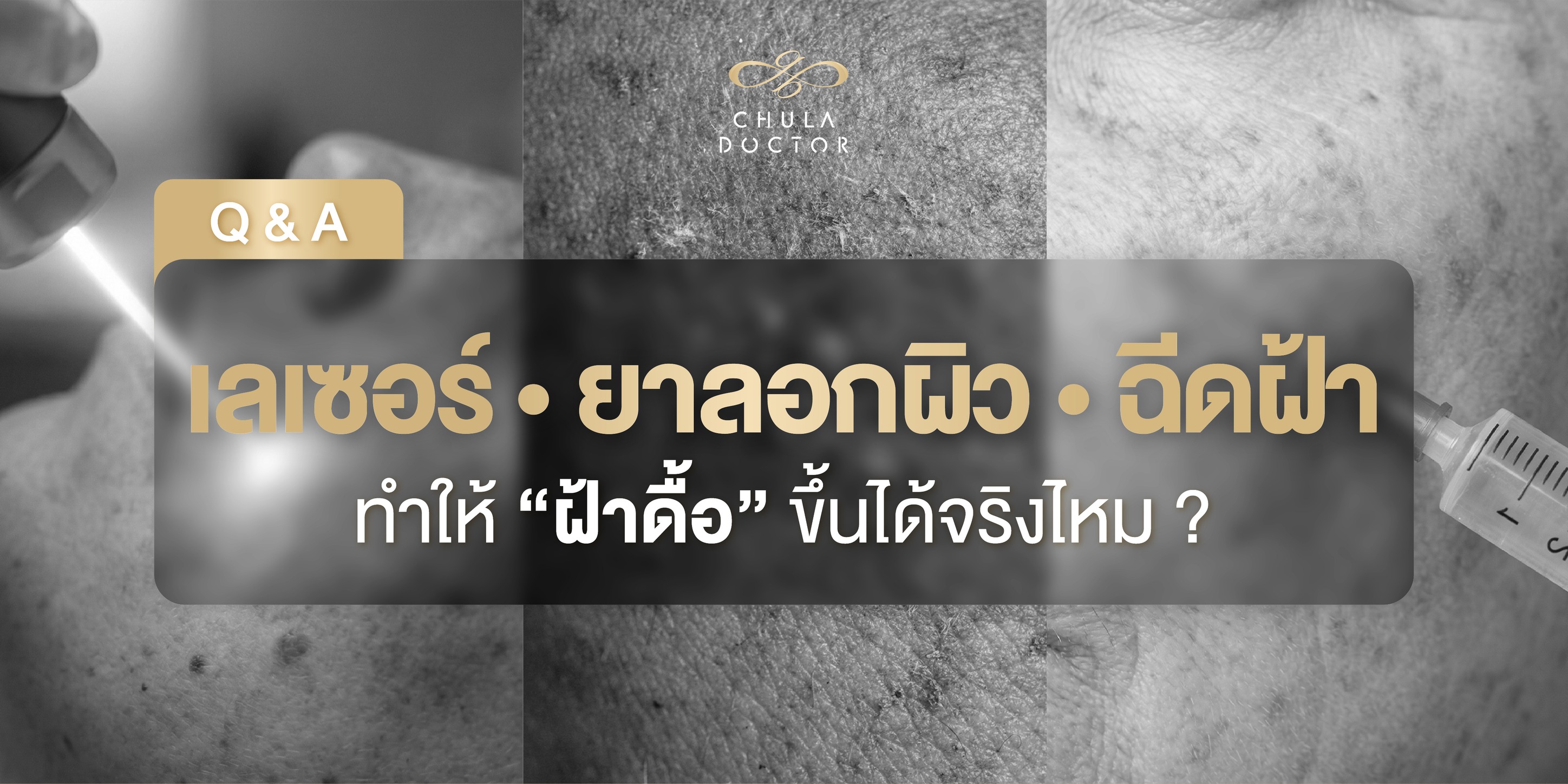 ฟื้นฟูฝ้าไม่ใช้ความร้อน Chuladoctor Wellness Facebook ad