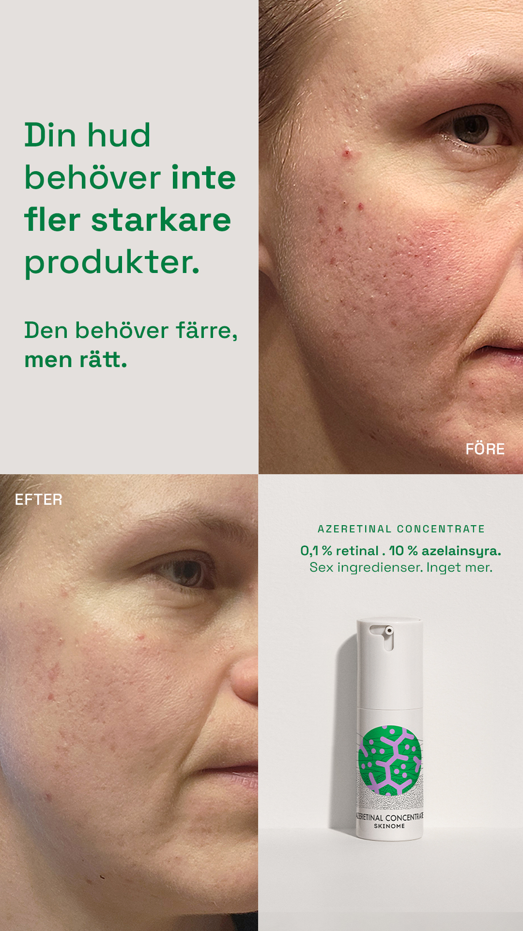 Skinome Facebook ad