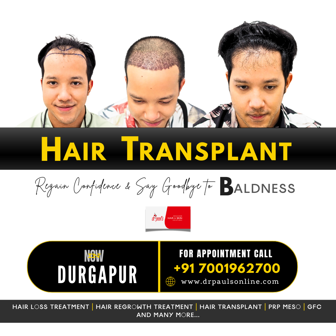 Dr. Paul's Advanced Hair & Skin Solutions, Durgapur Facebook ad: Hair Transplant Durgapur