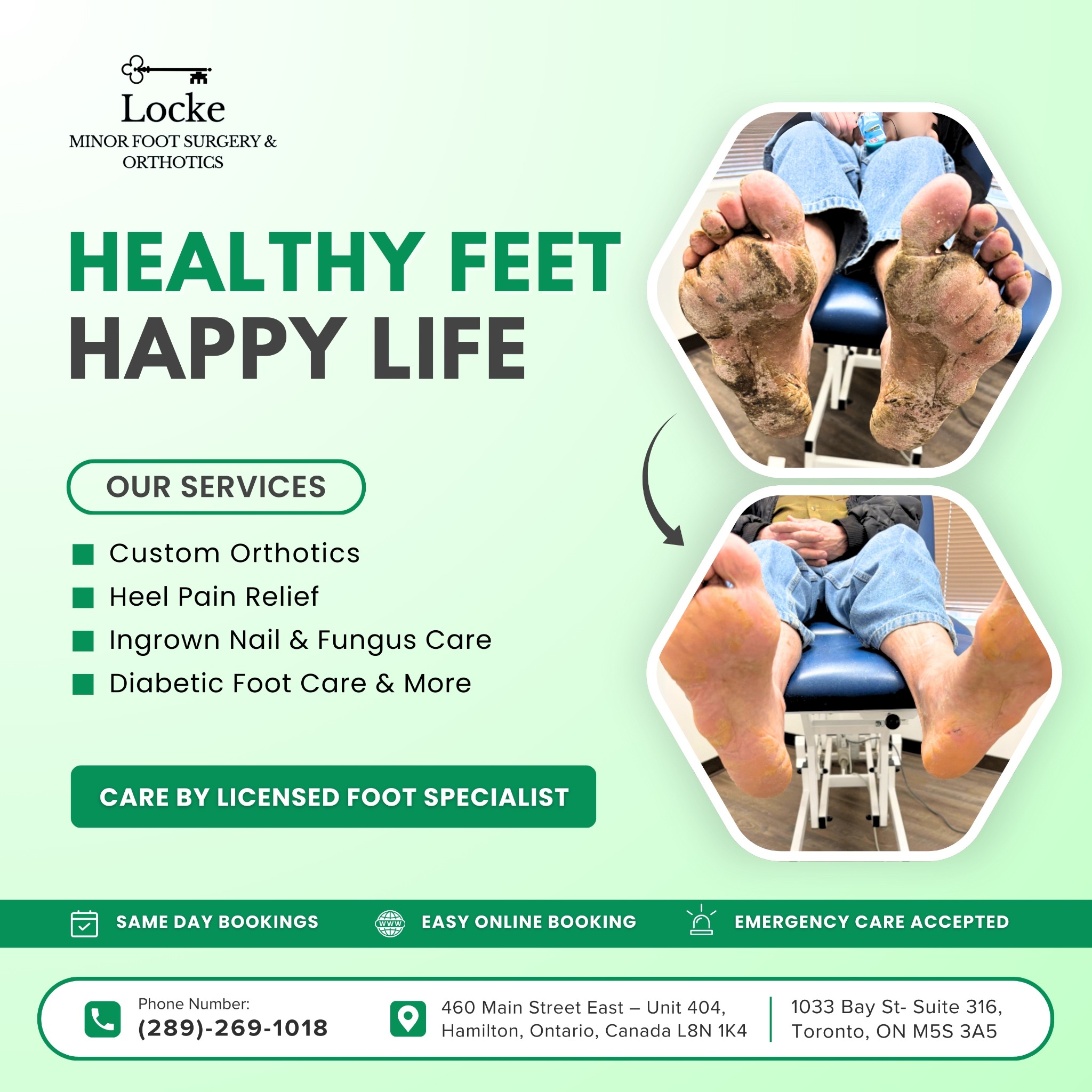 Locke Minor Foot Surgery & Orthotics Facebook ad