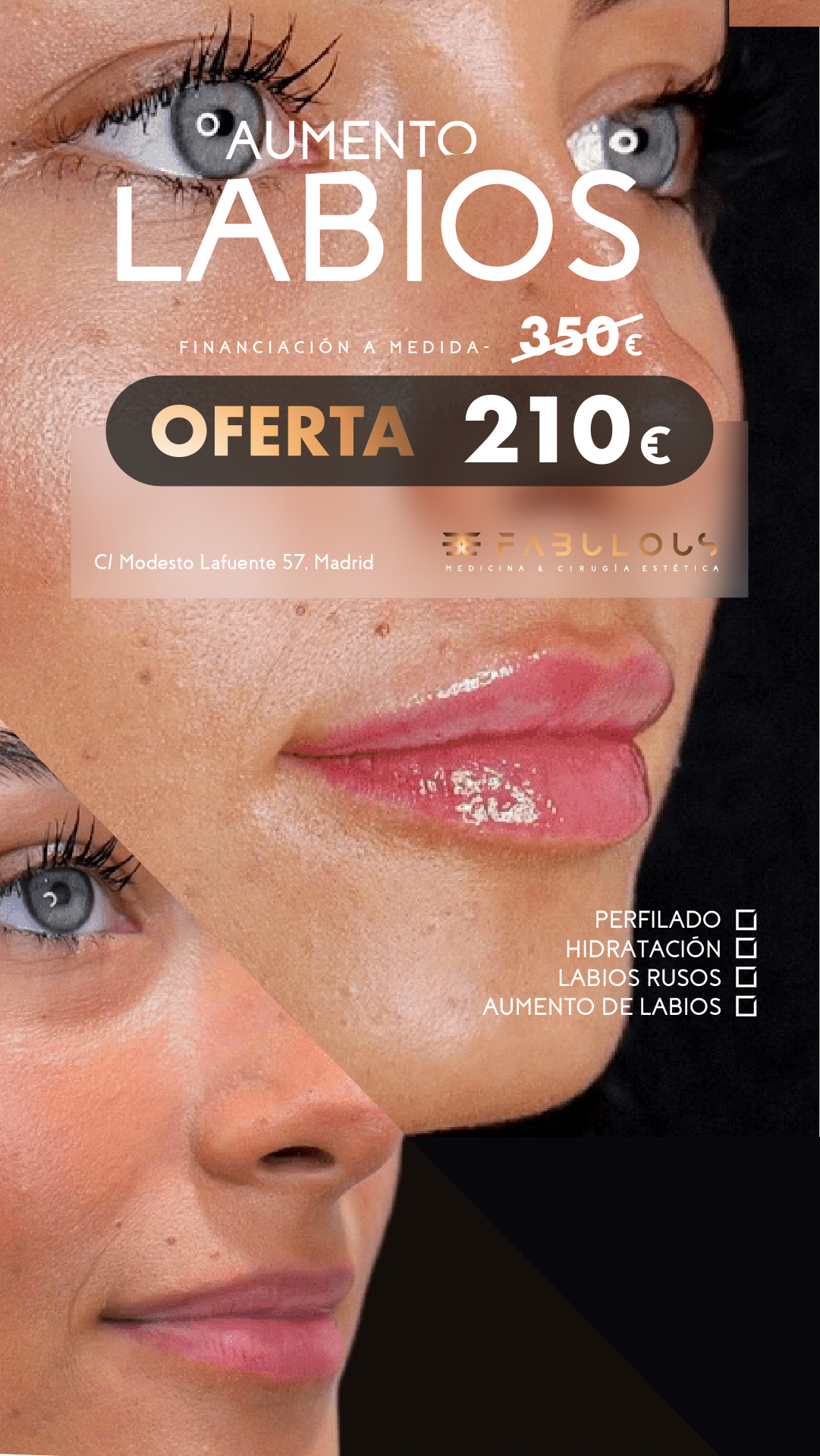 Clínica Be Fabulous Madrid Facebook ad from May 29, 2026