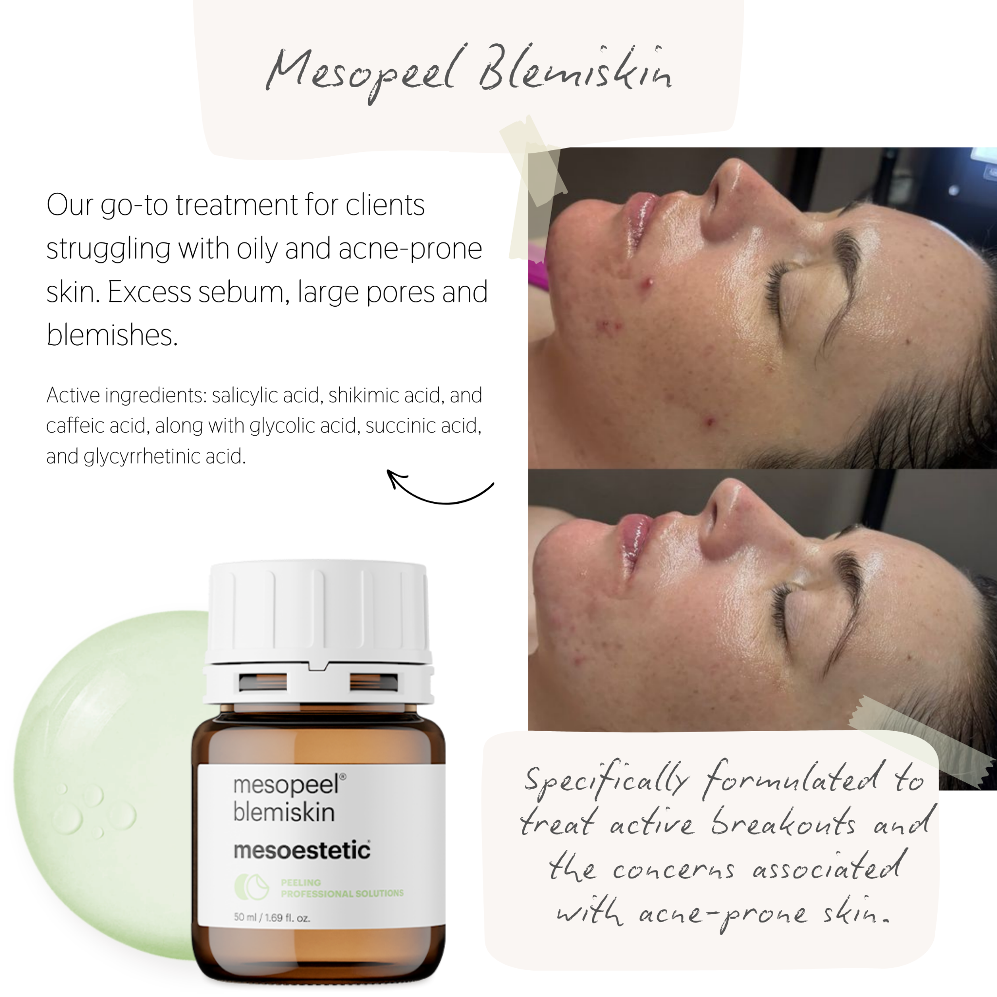 Future Face Clinics Facebook ad: You’ve already been looking into skin treatments… this…
