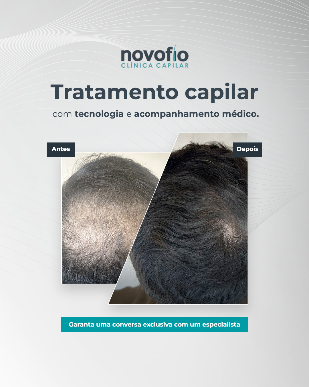 Novofio Belo Horizonte Clinica Capilar Facebook ad