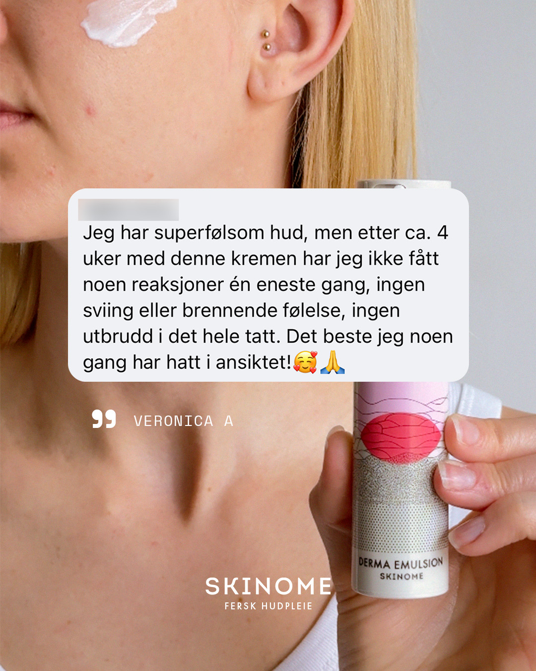 Skinome Facebook ad