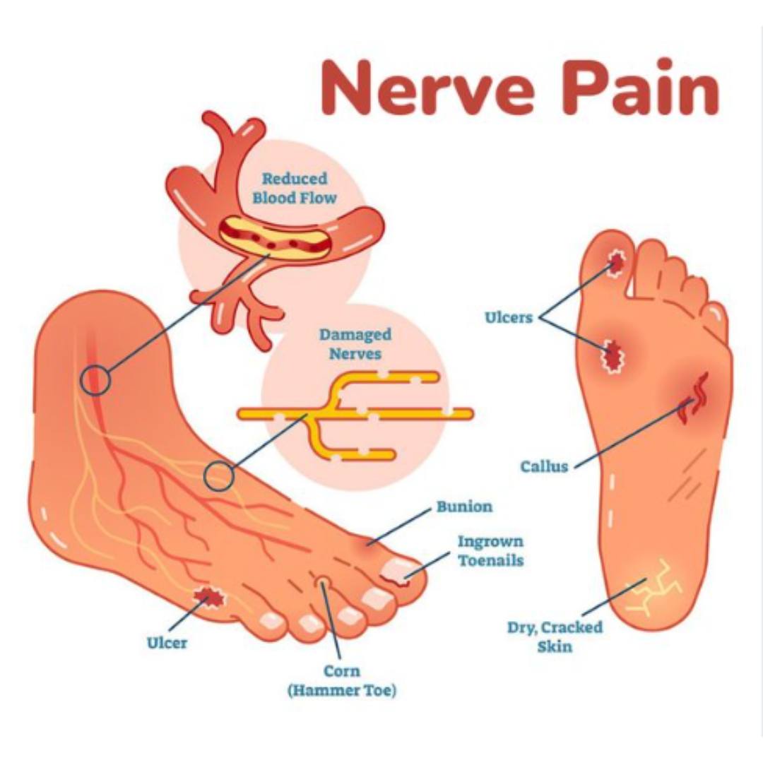 Ancaster Chiropractic and Laser Facebook ad: Claim Your $57 Pain Relief Consultation