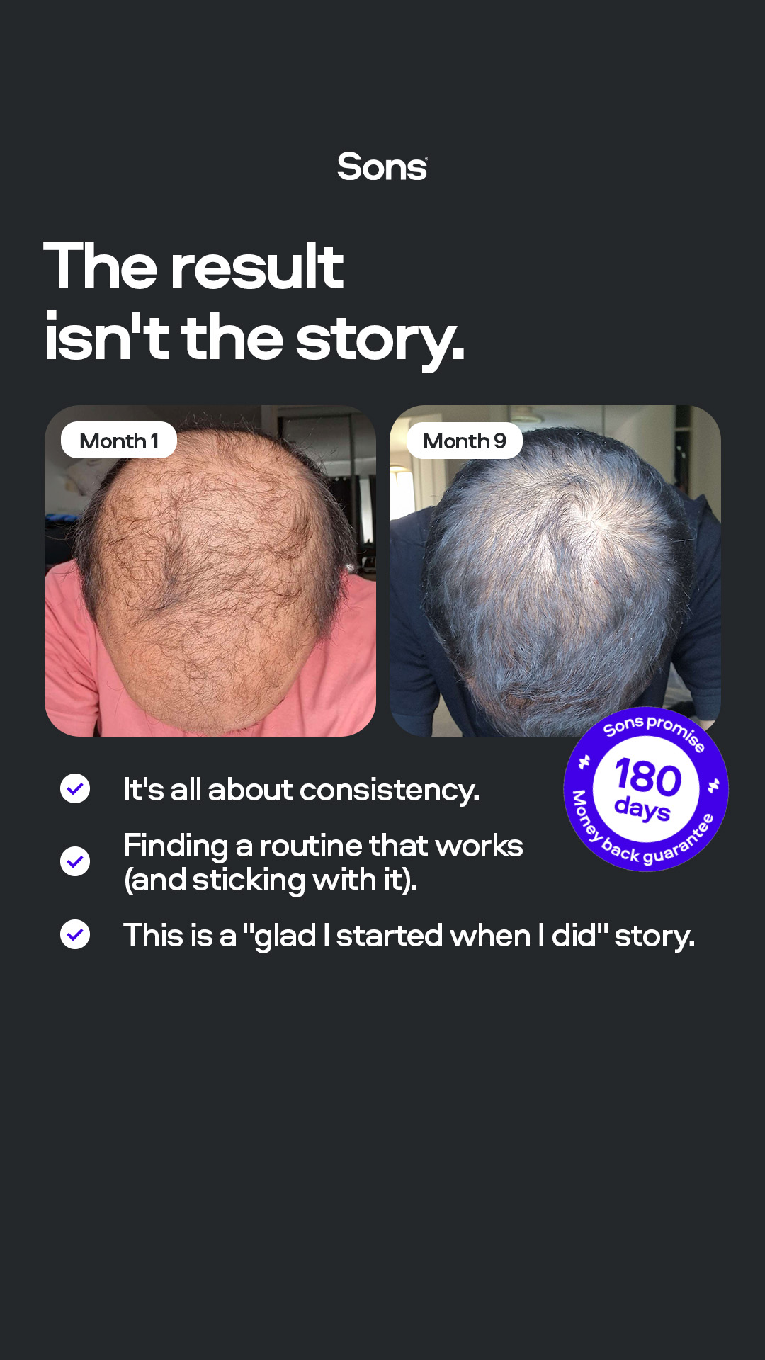 Sons Facebook ad: Your hairline. Your call.