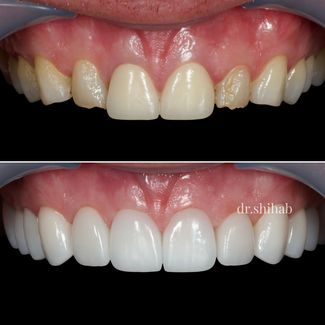LASER DENTAL Facebook ad