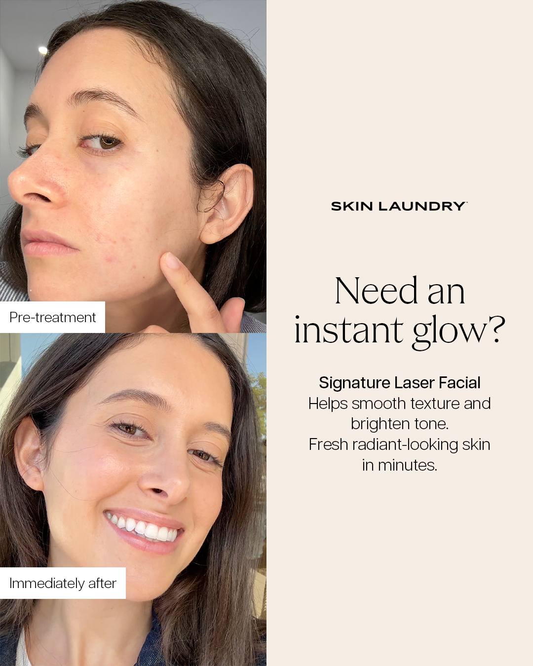 Skin Laundry Facebook ad