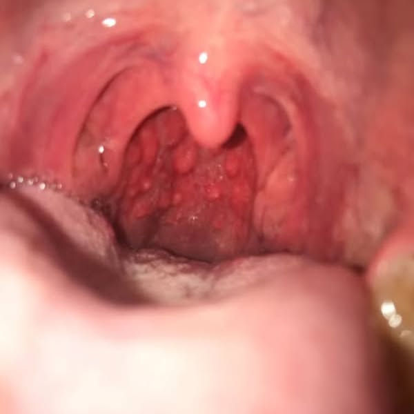 Dr. Monica Olsen Facebook ad