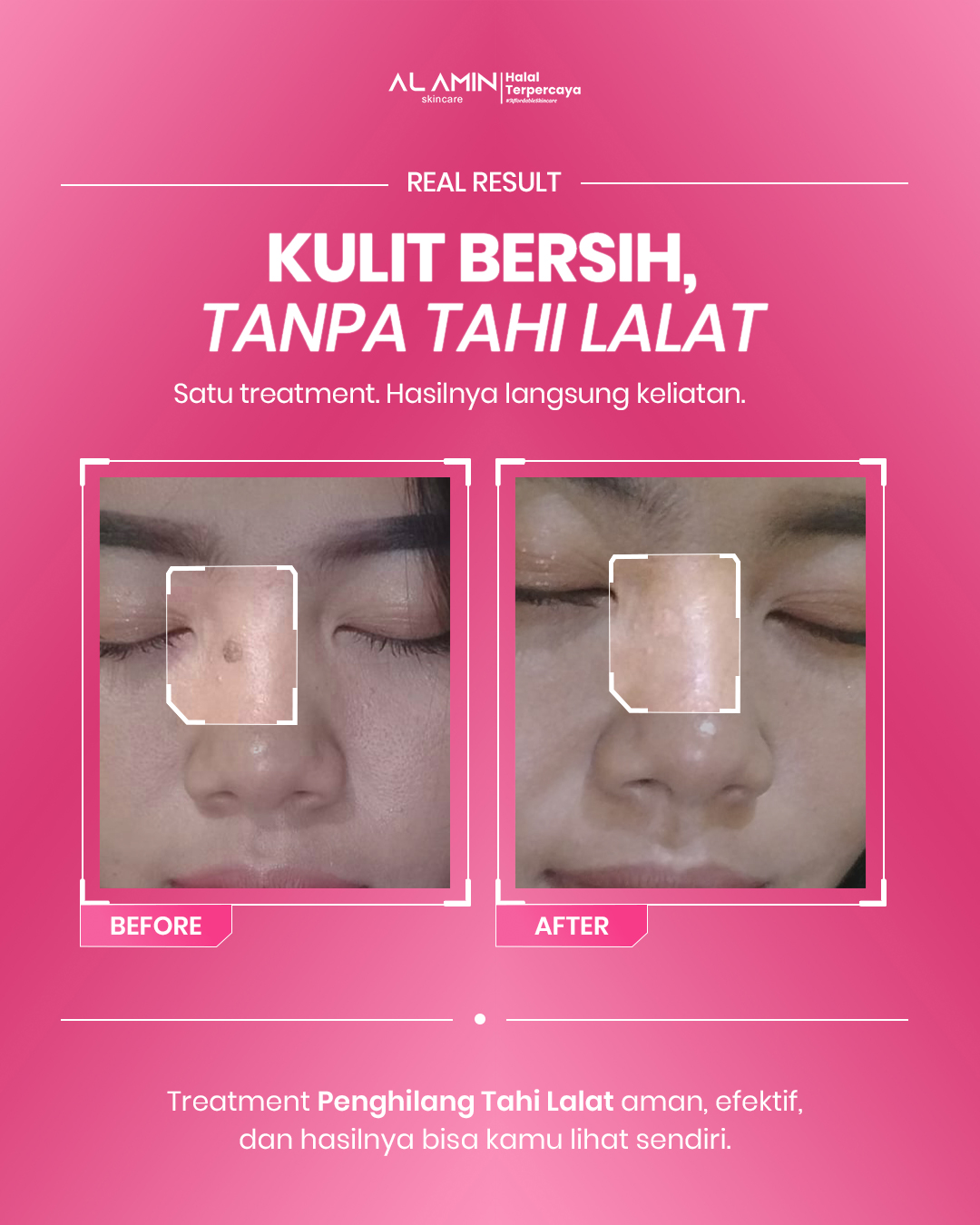 Alamin skincare Facebook ad
