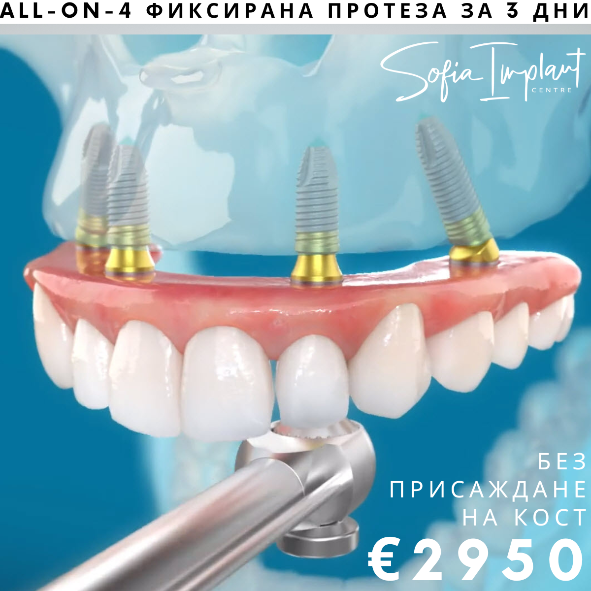 Sofia Implant Centre Facebook ad