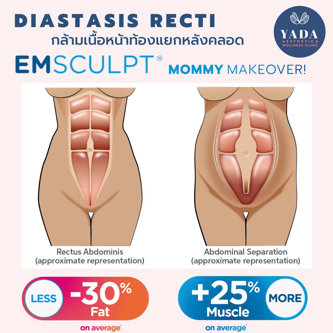 Yada Clinic Pattaya Facebook ad