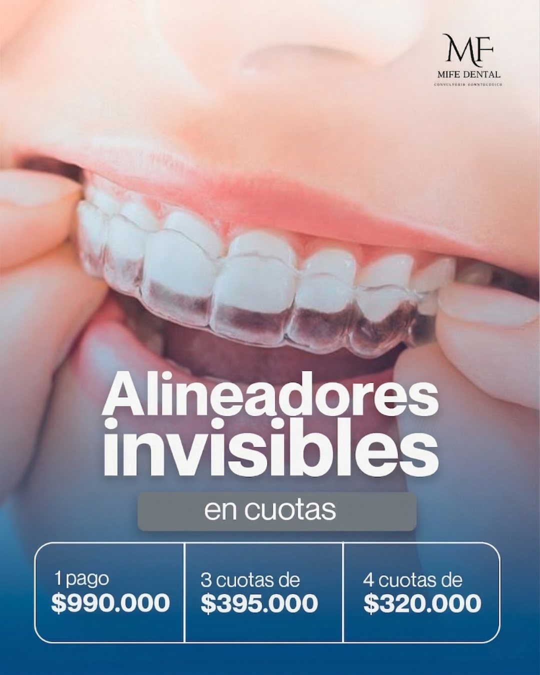Mife dental group Facebook ad