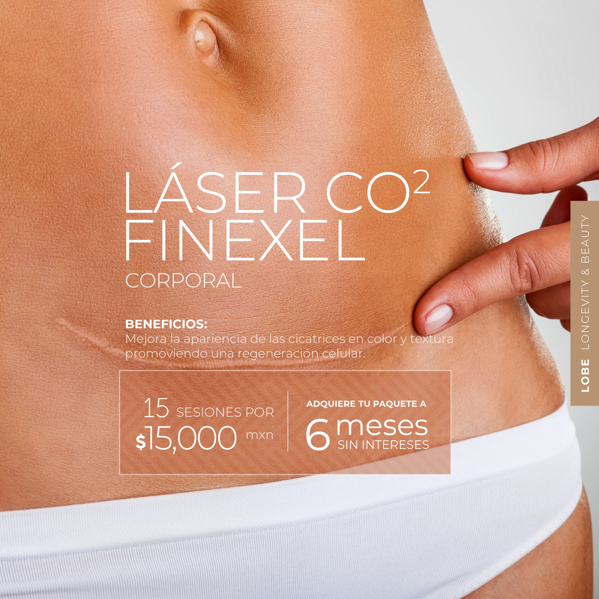 LOBE Clinic Facebook ad: ¿Tienes cicatrices que quieres mejorar?