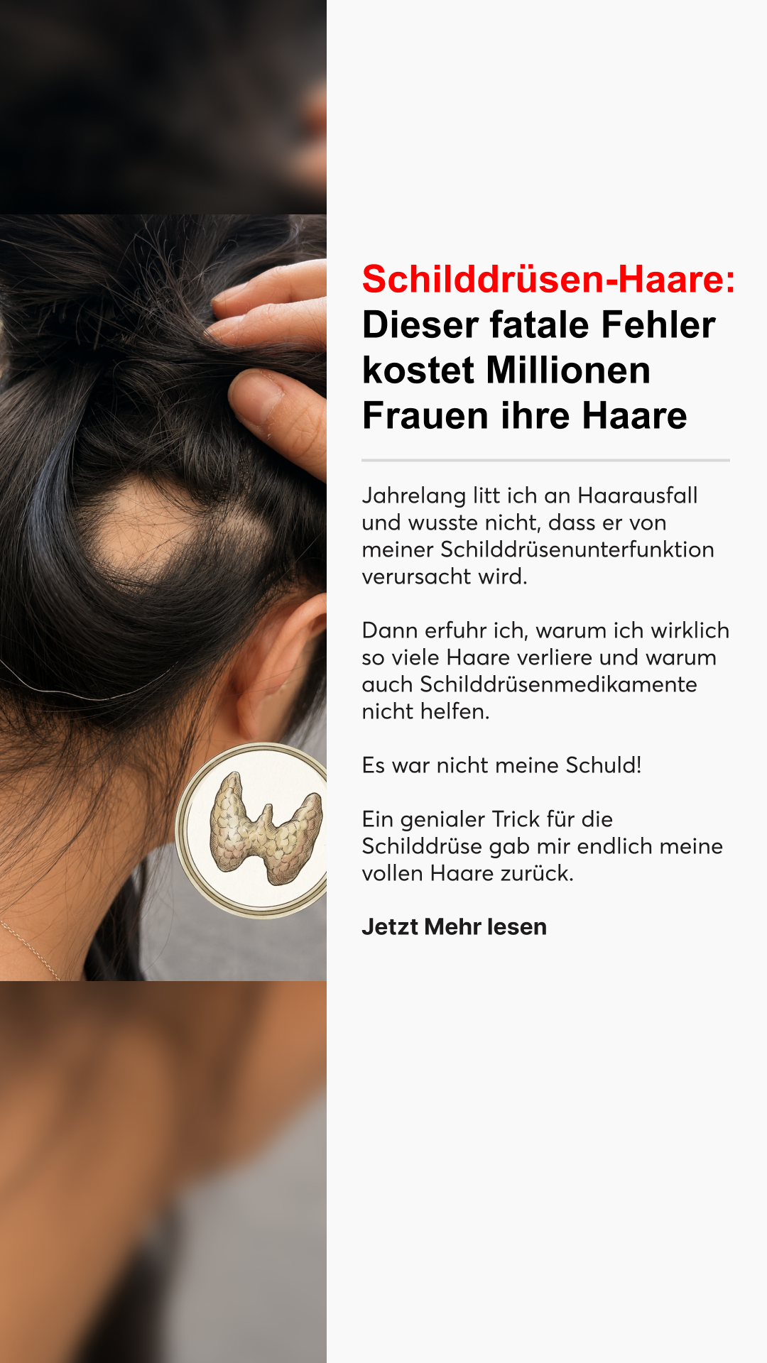 Mission Schilddrüse Facebook ad