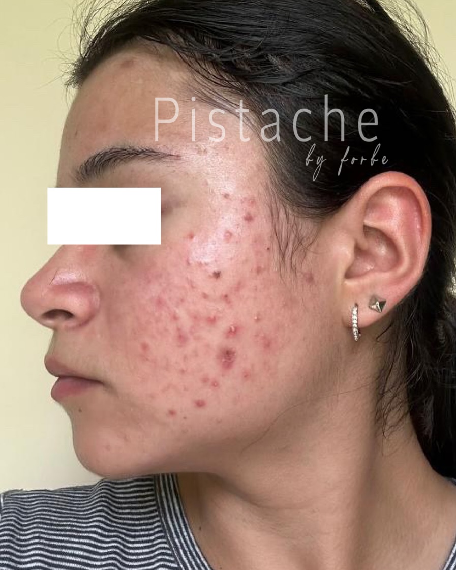 Pistache Facebook ad