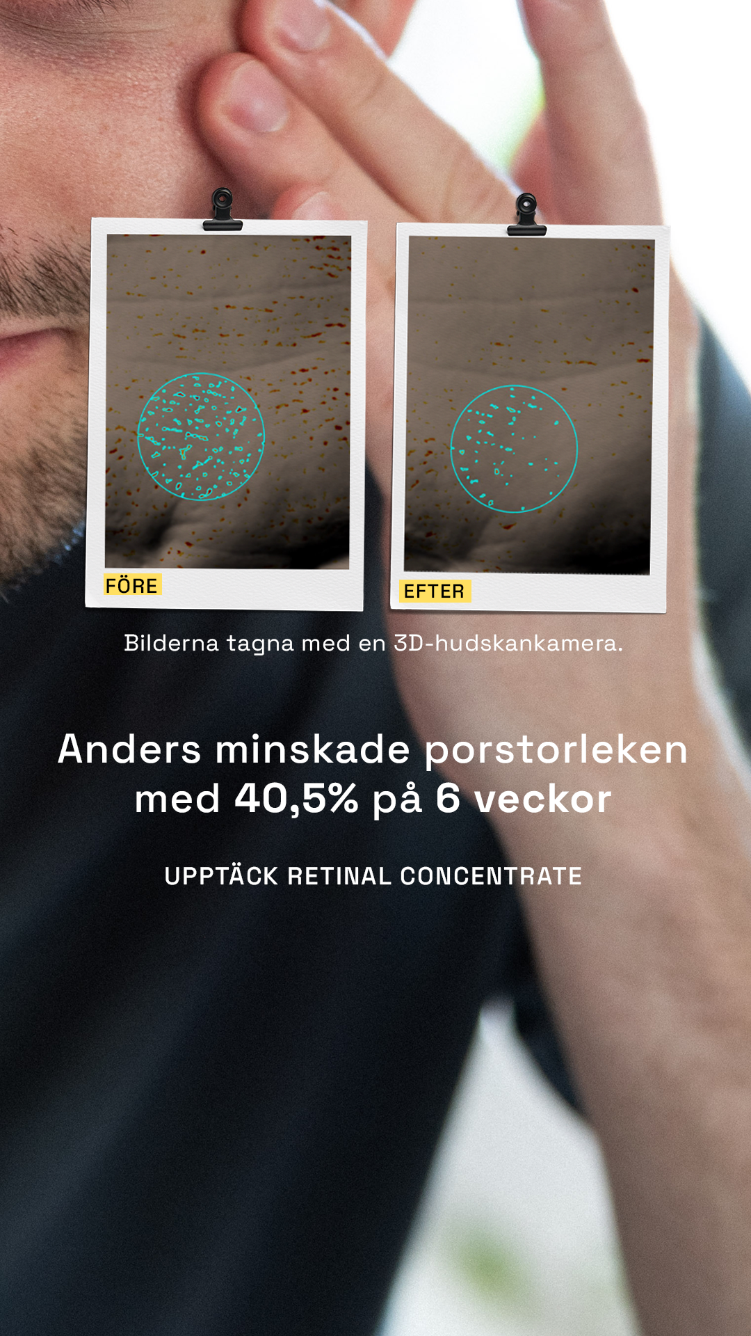 Skinome Facebook ad