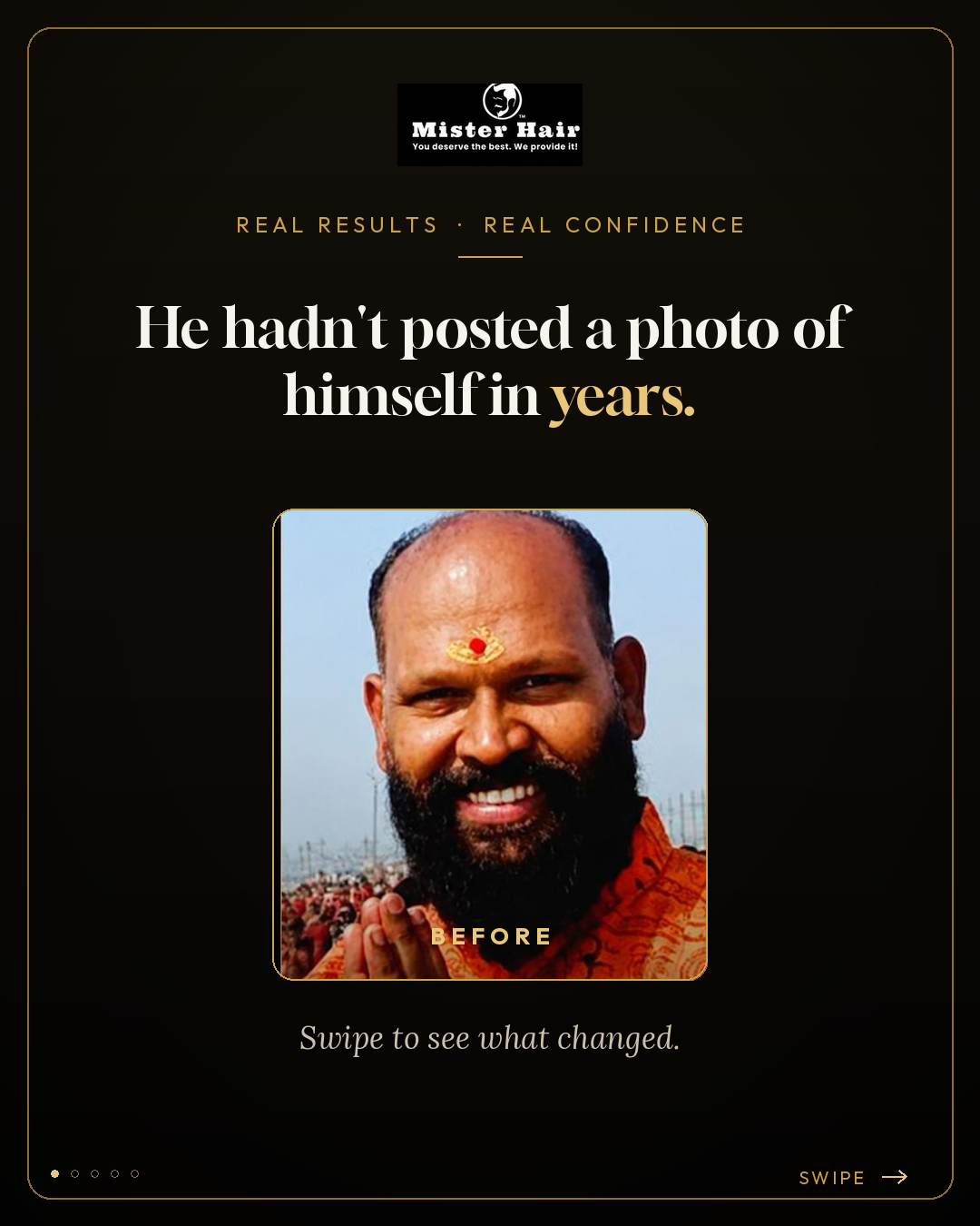 Mister Hair Clinic Facebook ad: Bangalore’s Trusted Hair Transformation Clinic