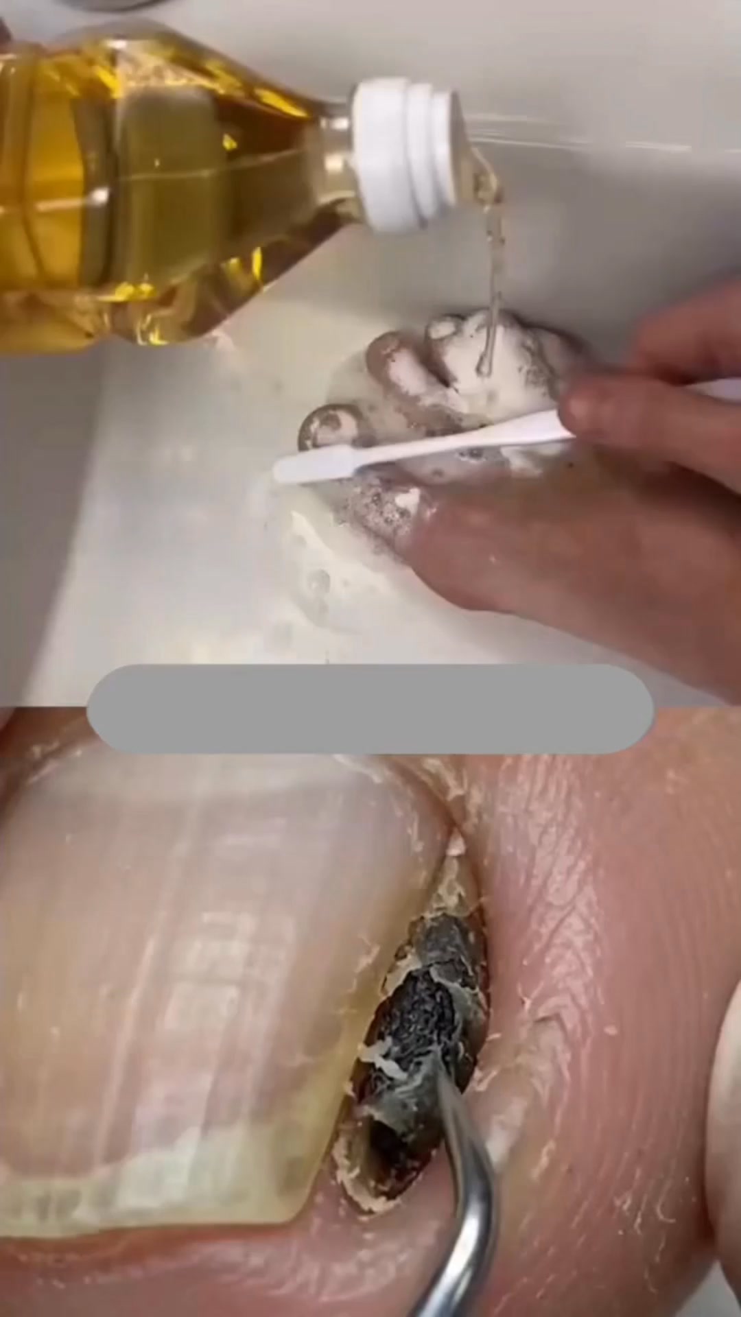 Đặng Quang Facebook ad: Det största misstaget vid nagelsvamp