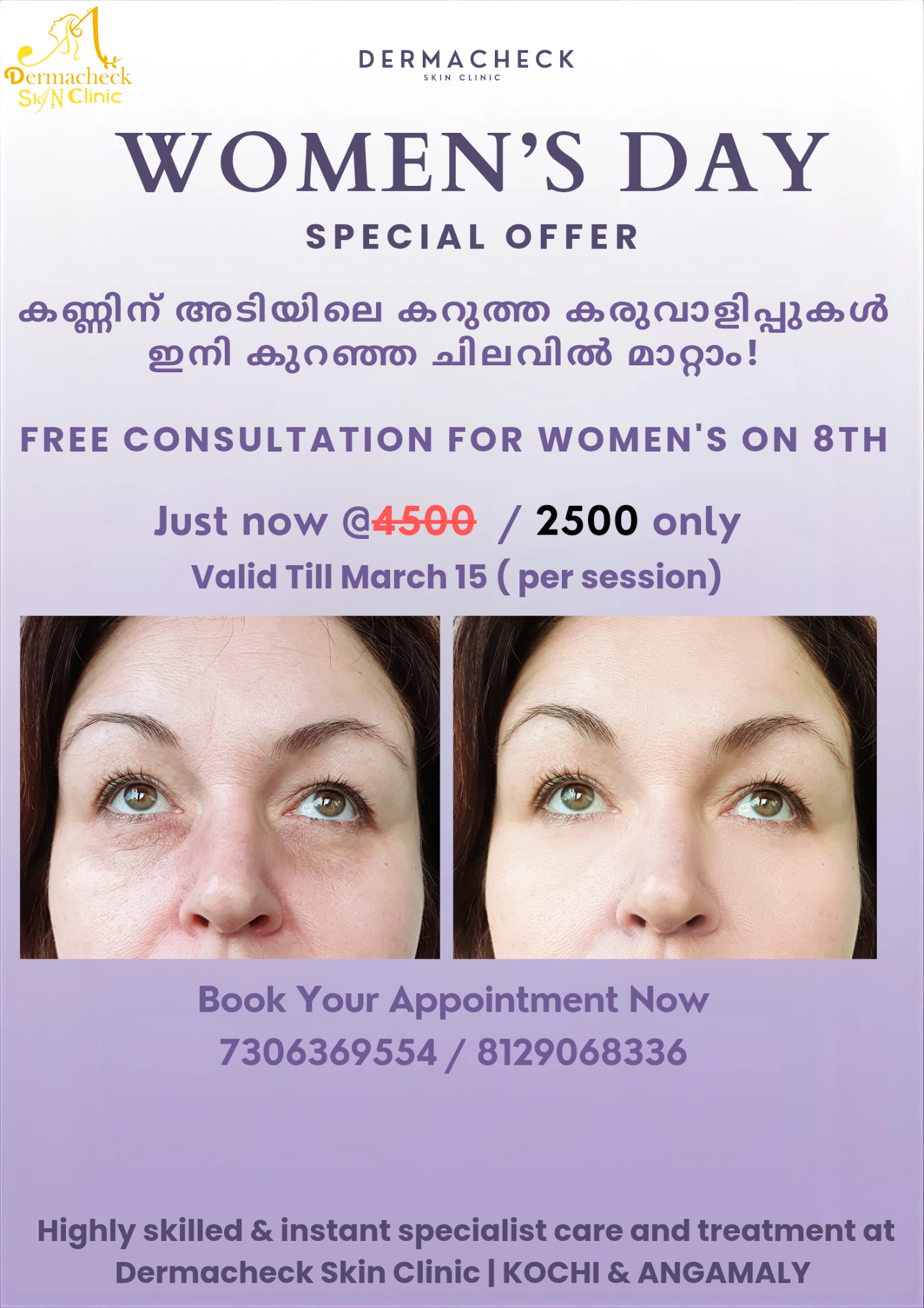 DermaCheck Skin Clinic Facebook ad: Women’s Day Skin Treatment Offer, ₹2500 Only