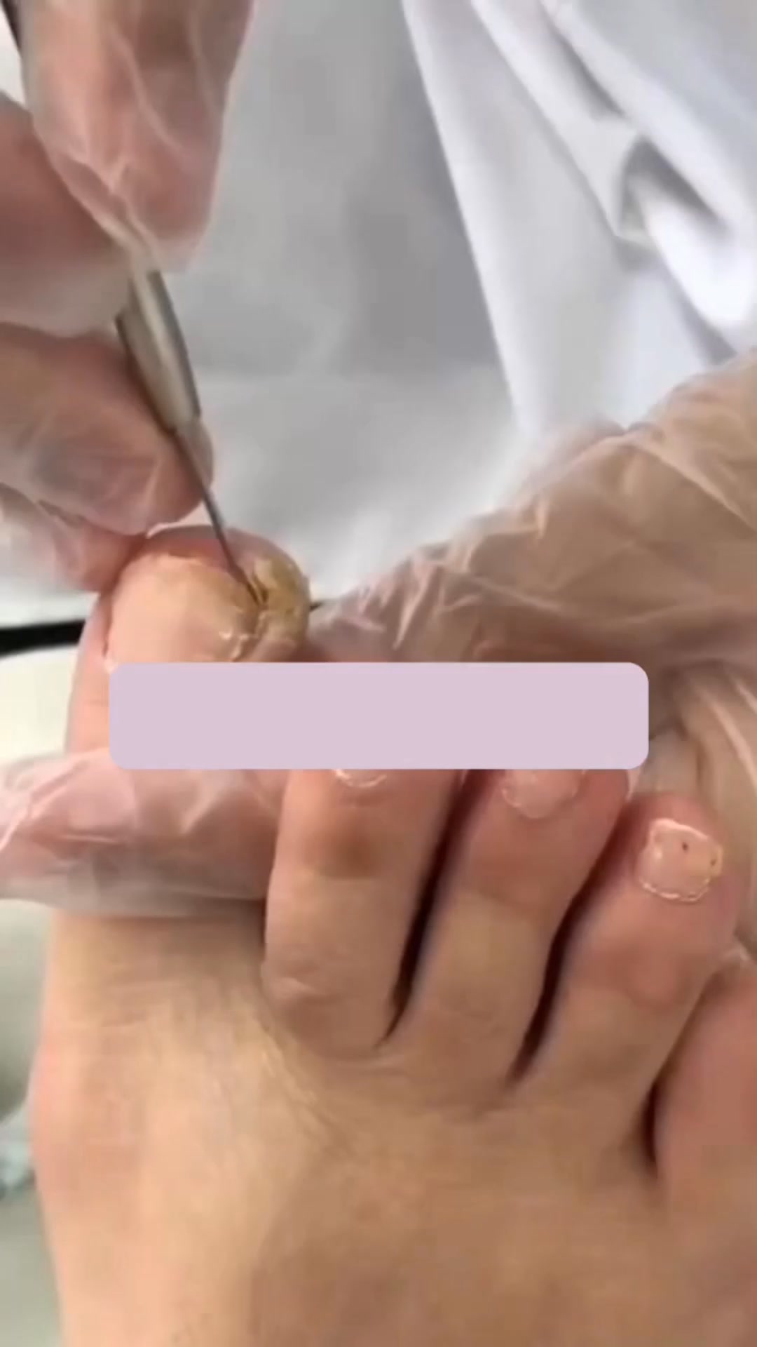 Đặng Quang Facebook ad: Det största misstaget vid nagelsvamp