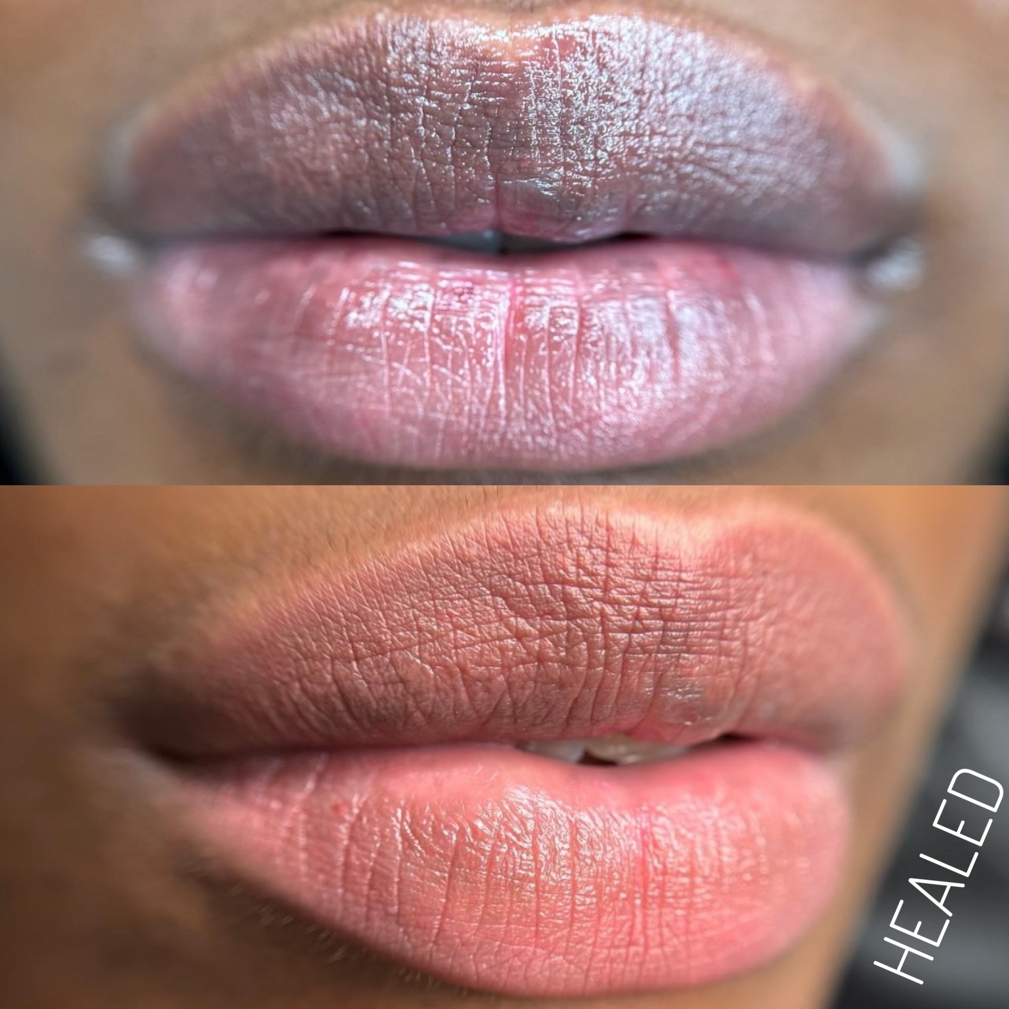 yemelyanova_permanent Facebook ad: DARK LIPS NEUTRALIZATION TATTOO, REAL RESULTS AFTER JUST…