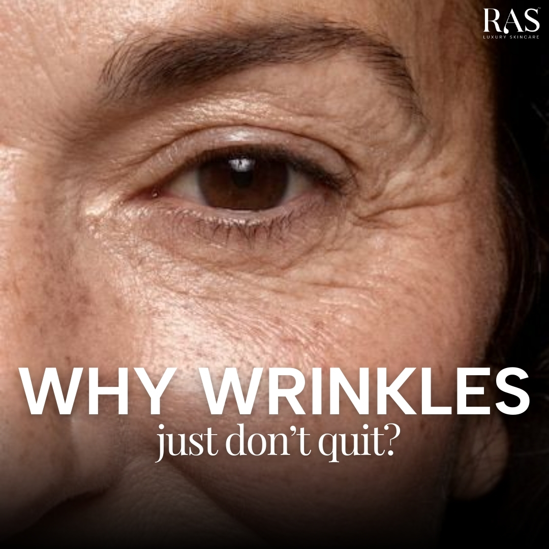 RAS Luxury Oils Facebook ad
