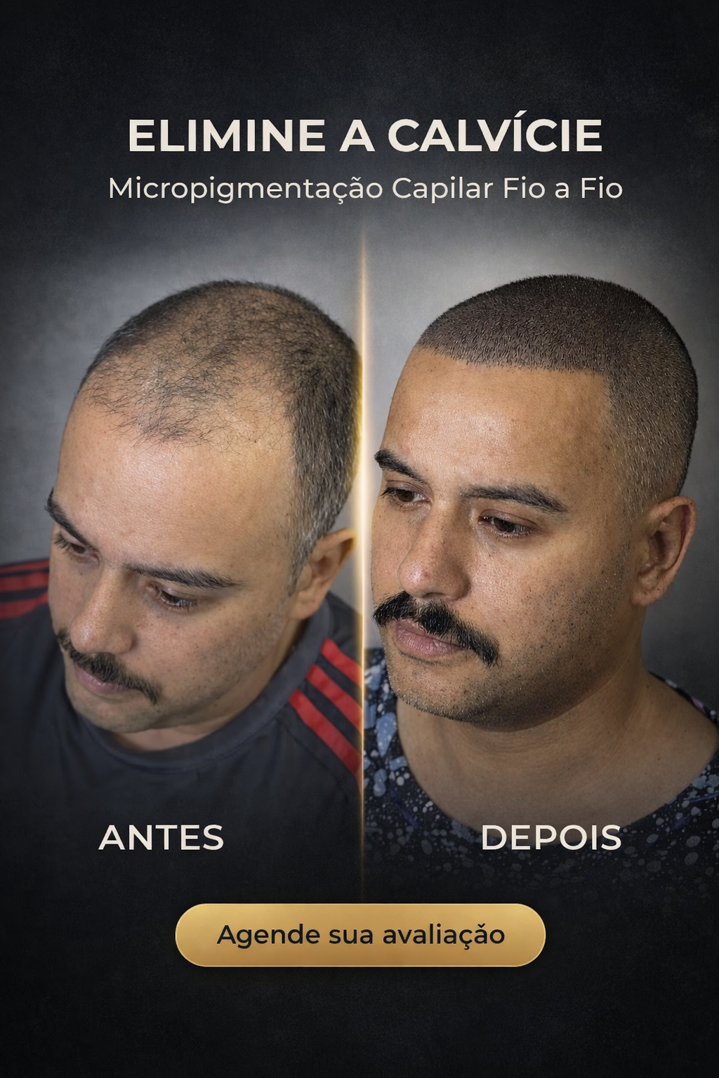 Micropigmentação Capilar em Goiânia - JK Capilar Facebook ad: ELIMINE A CALVÍCIE