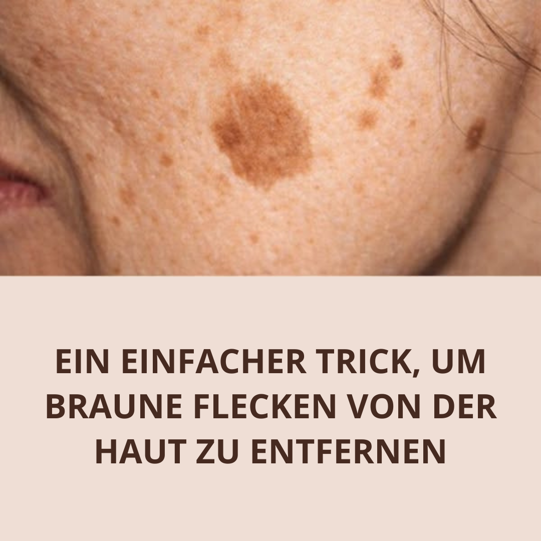 Karen Bell Facebook ad: Stellt Einen Ebenmäßigen Teint Wieder Her Und Entfernt…
