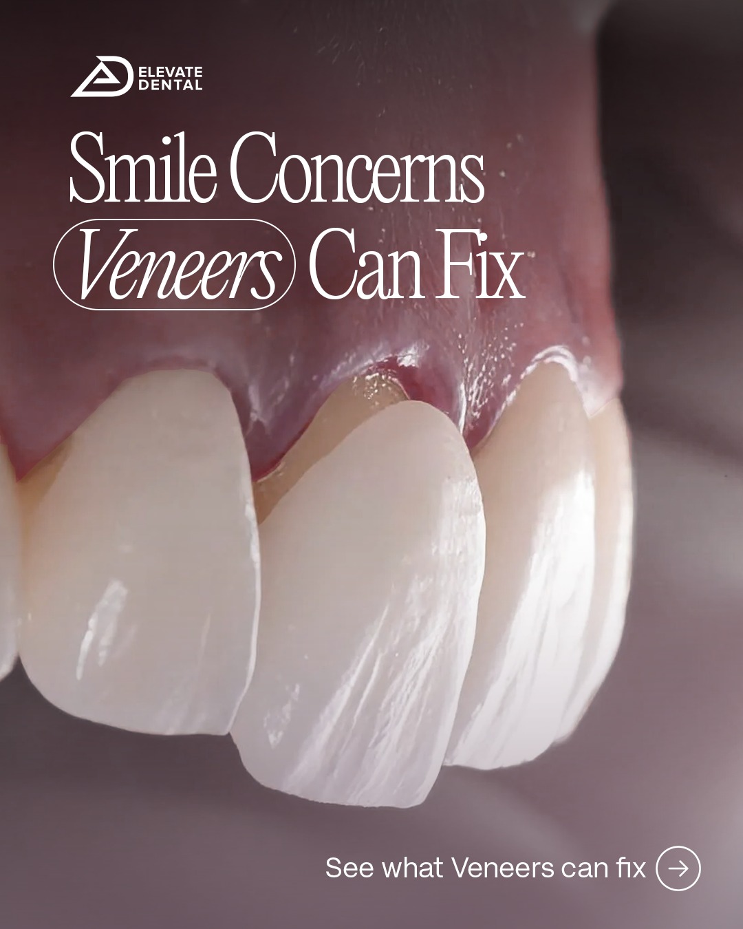 Elevate Dental PH Facebook ad: A beautiful smile is more than an aesthetic…
