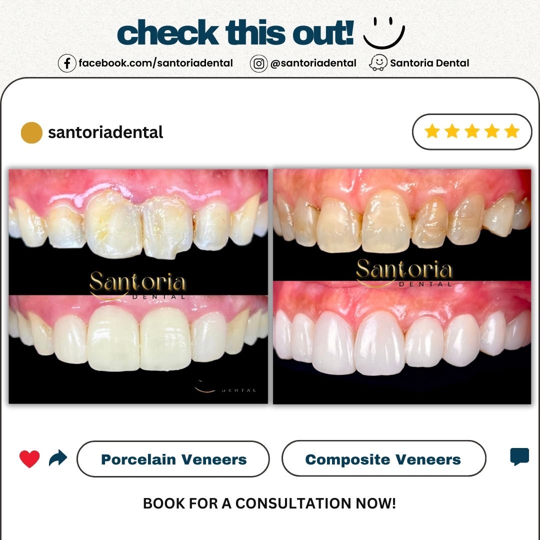 Santoria Dental Facebook ad