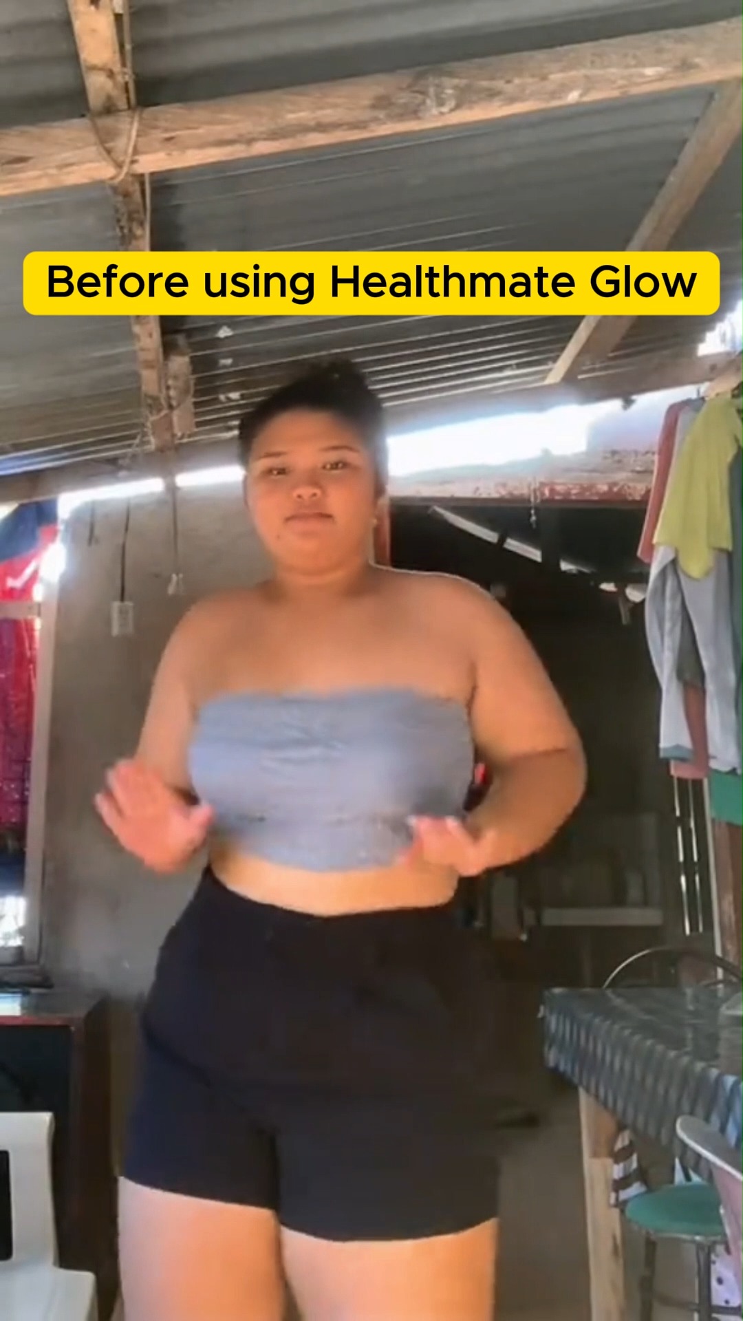 Healthmate Supplements Facebook ad: GUSTO MO BA NG MAS MAKINAG NA BALATโฆ