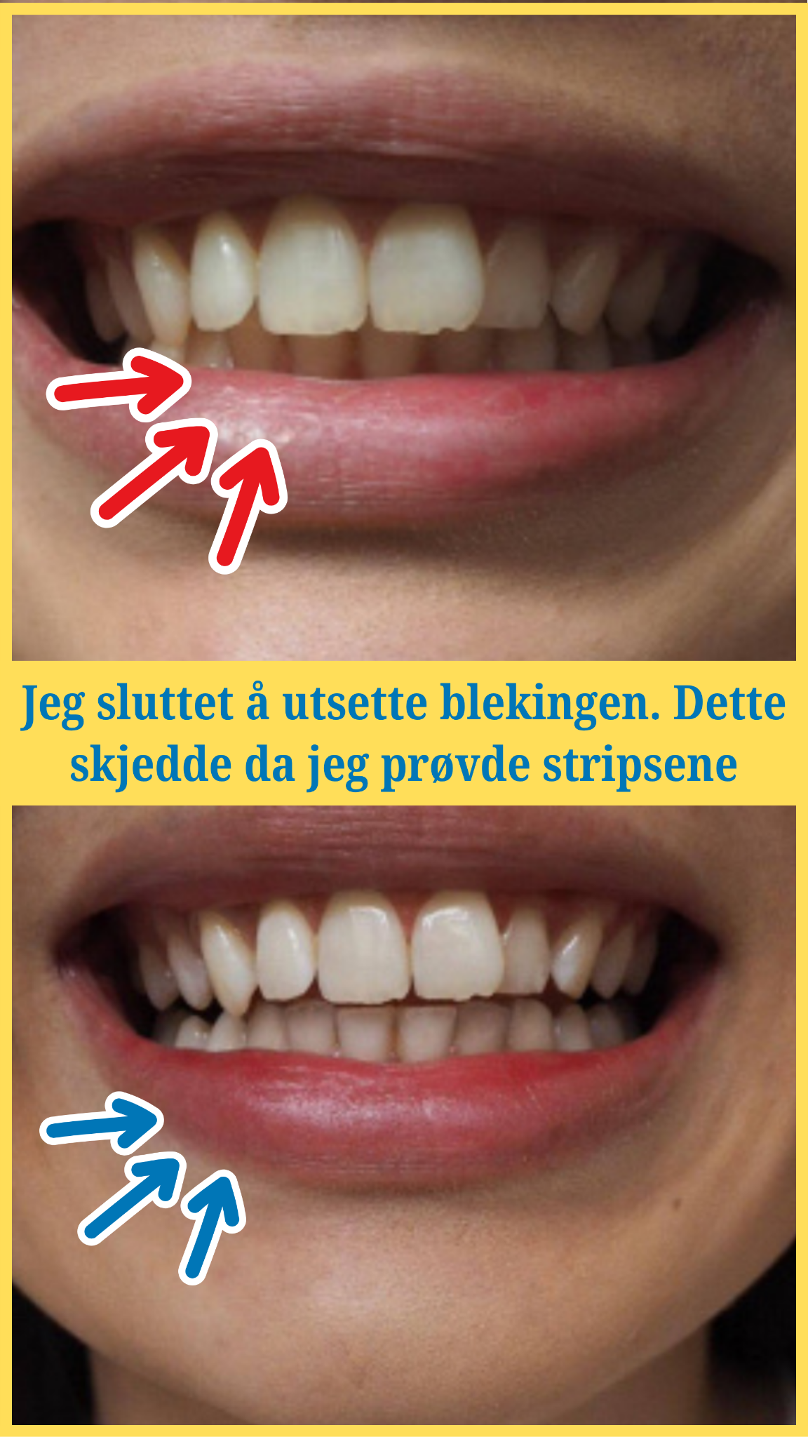 ProWhitening Facebook ad