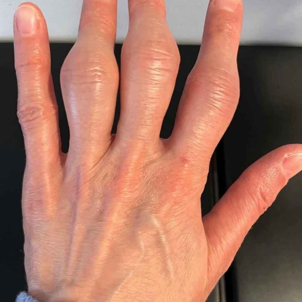 The Menopause Journal Facebook ad: Menopause did this to her hands