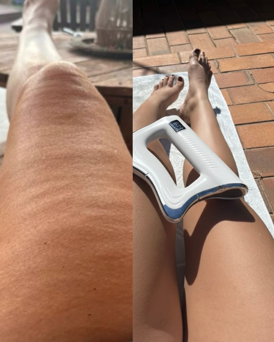 Anastasia Facebook ad: Für alle mit Cellulite trotz Training