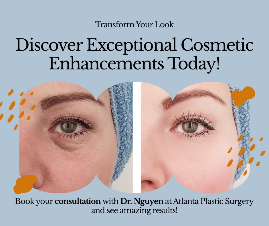 Dr. Jonathan T. Nguyen, MD - Plastic & Reconstructive Surgeon Facebook ad: Natural Aesthetics