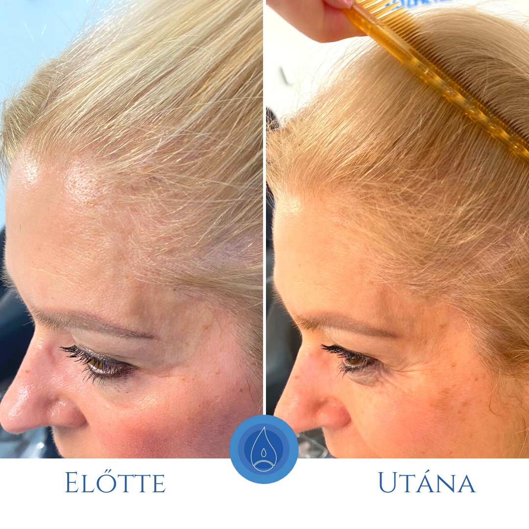 Oxygeni Hair & Skin Hajgyógyász és Bőrterápia Szalon Győr Facebook ad