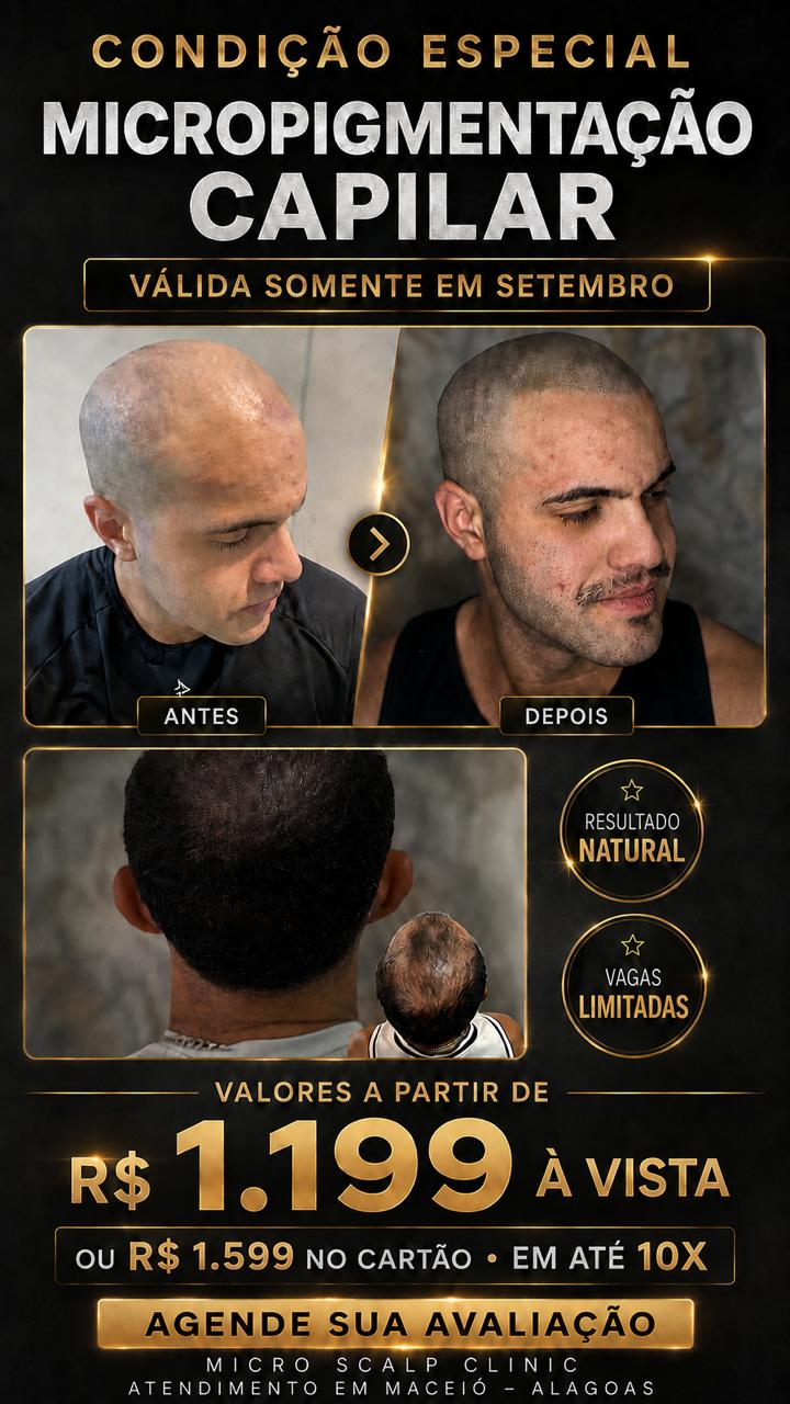 Rafaela Moura Micro Scalp Clinic Facebook ad: Livre-se da calvície em até 15 dias!